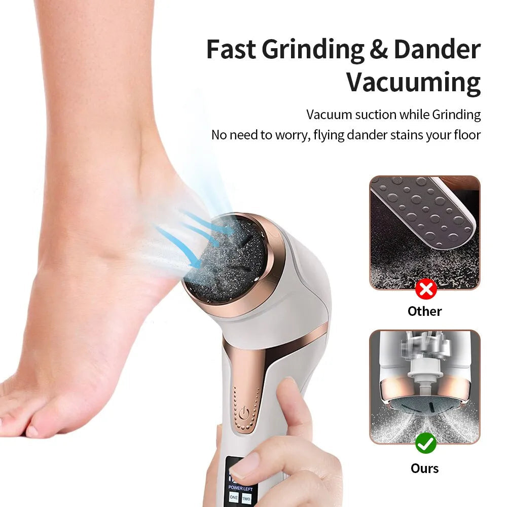 Electronic Foot Files Portable Foot Callus Remover