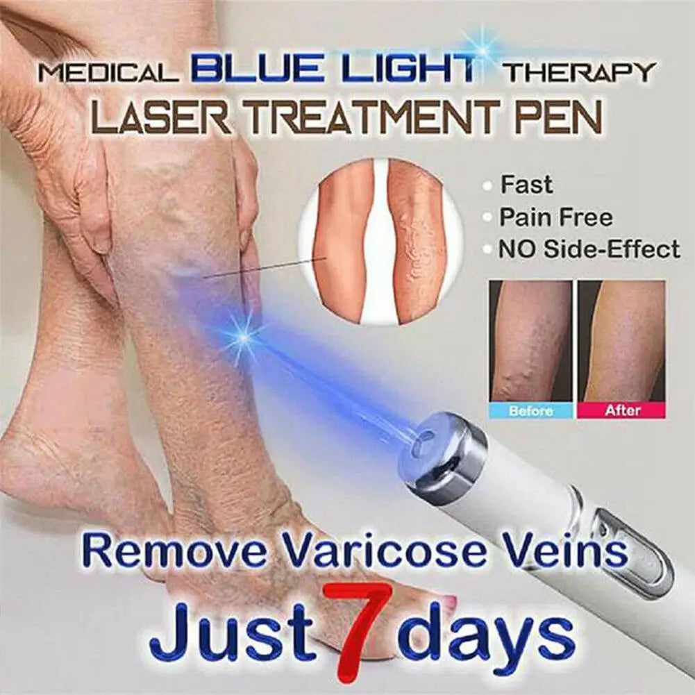 Blue Light Therapy Acne Laser Pen