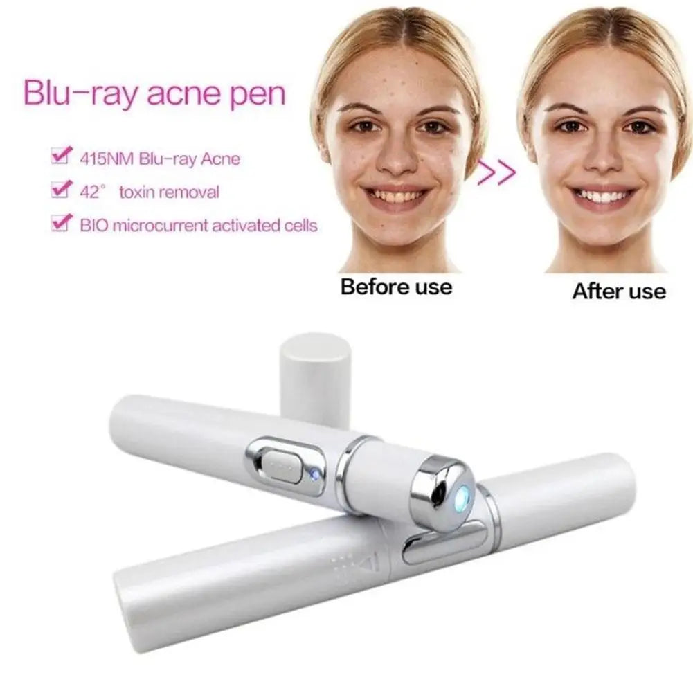 Blue Light Therapy Acne Laser Pen